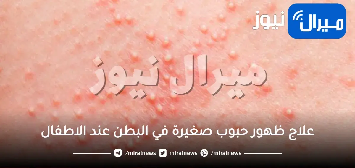 علاج ظهور حبوب صغيرة في البطن فجأة مع حكة عند الأطفال