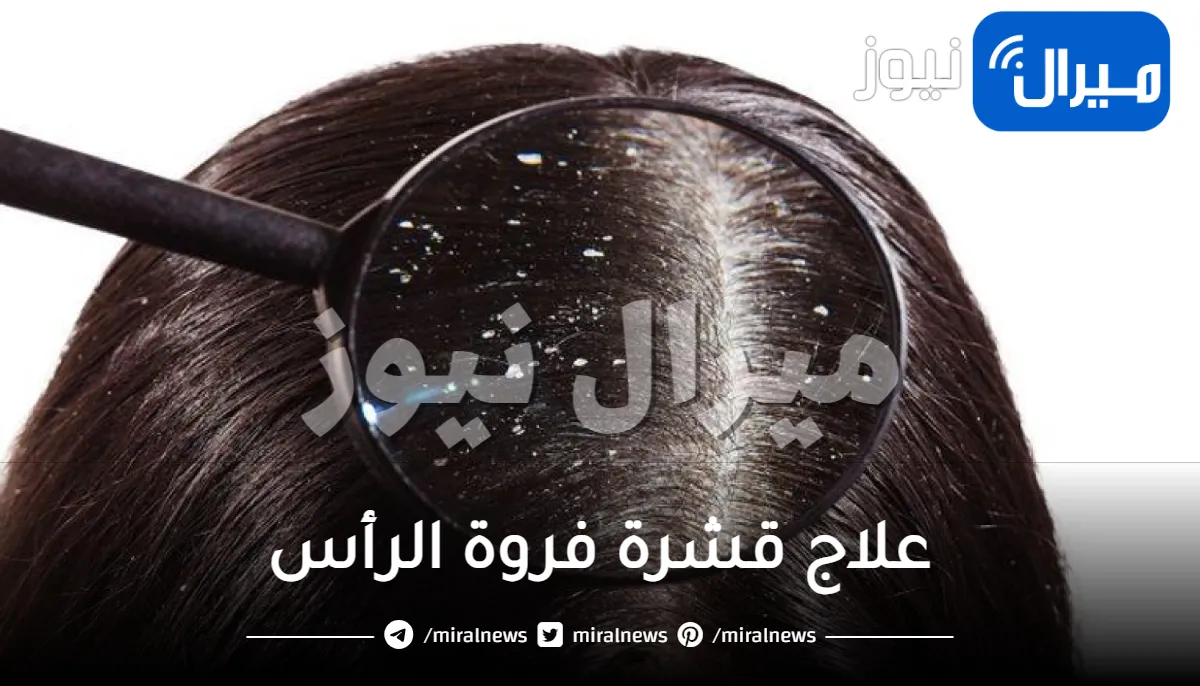 ماهي أفضل الوصفات لعلاج قشرة فروة الرأس ؟