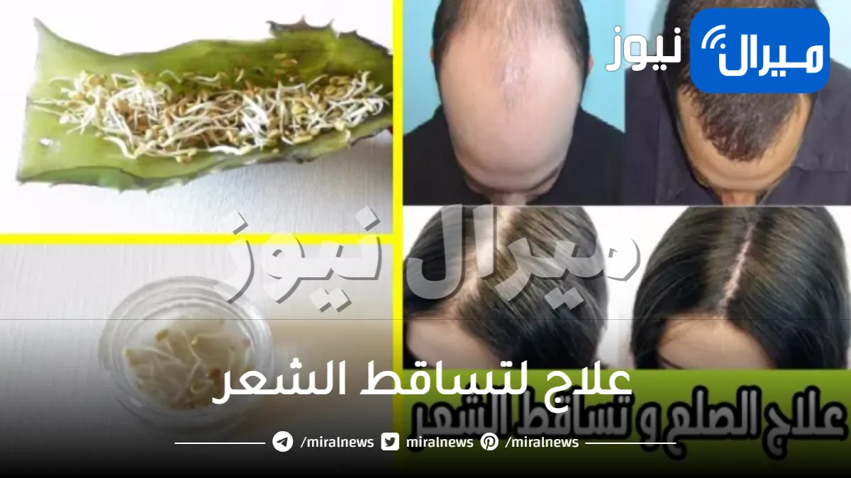 كيفية علاج تساقط الشعر ؟