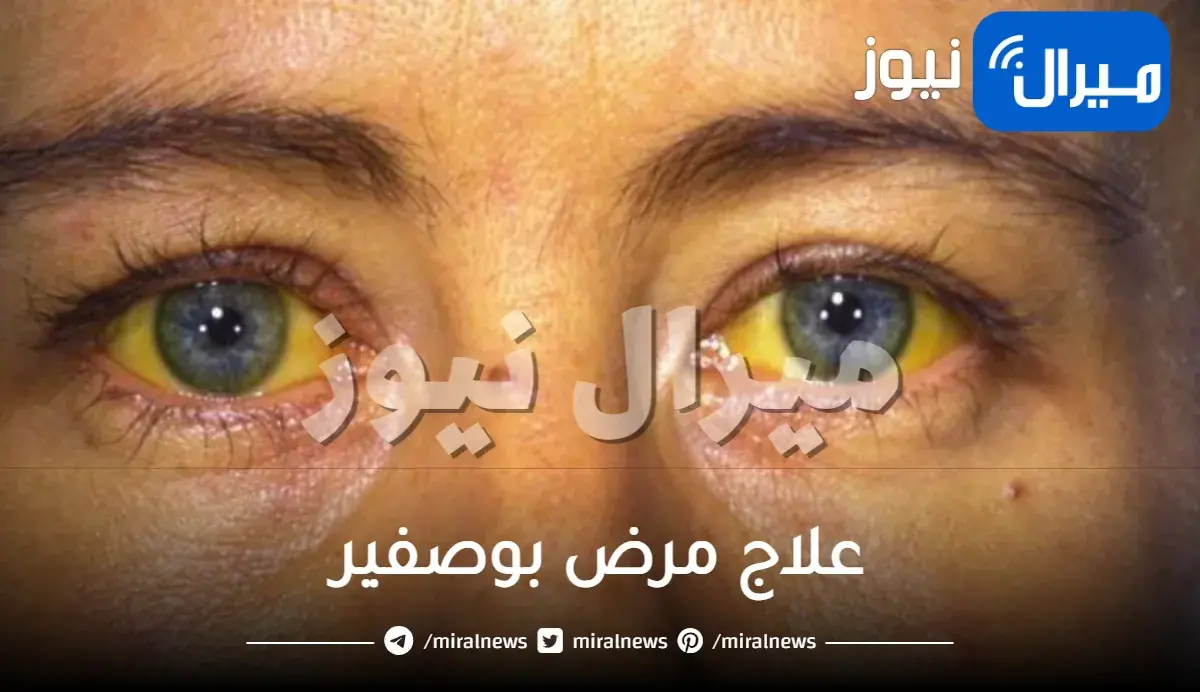 علاج مرض بوصفير بالأعشاب عند الكبار بالكركم