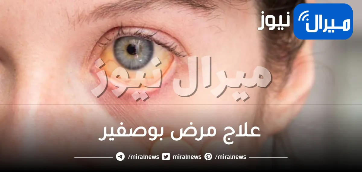 علاج مرض بوصفير بالأعشاب في البيت وأسباب الإصابة بمرض بوصفير