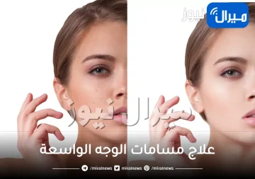 10 ماسكات منزلية لعلاج مسامات الوجه الواسعة