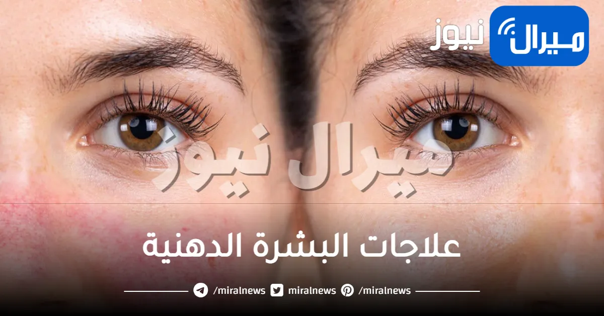 12 علاج للبشرة الدهنية