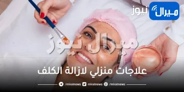 20 خلطة طبيعية لعلاج الكلف نهائيا