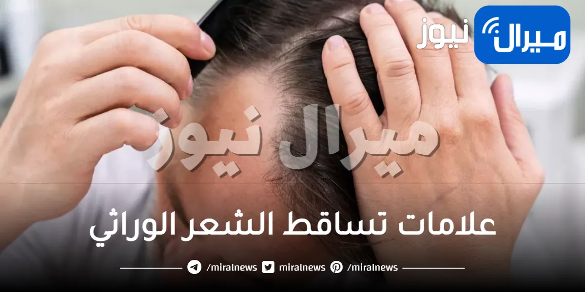 علامات تساقط الشعر الوراثي .. 3 علامات