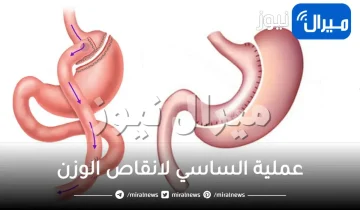 معلومات عن عملية الساسي لانقاص الوزن
