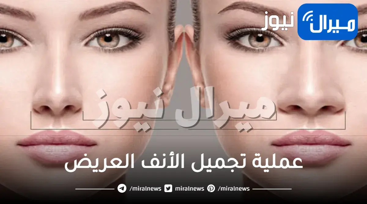 عملية تجميل الأنف العريض