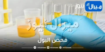 فحص البول