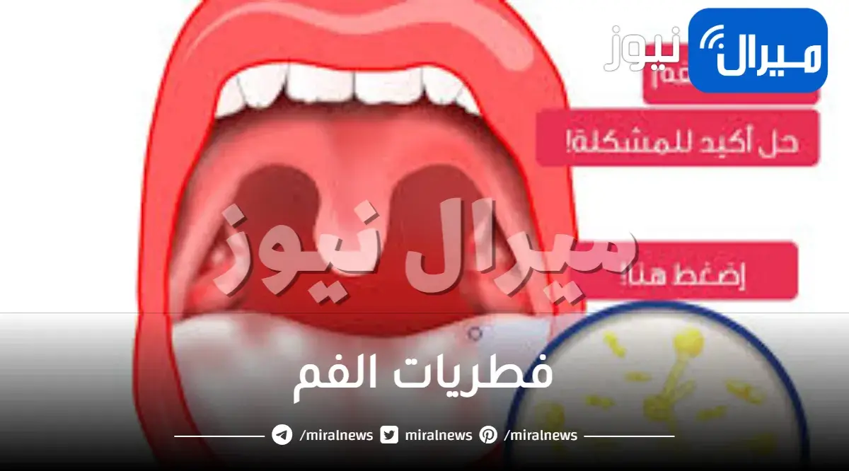 فطريات الفم