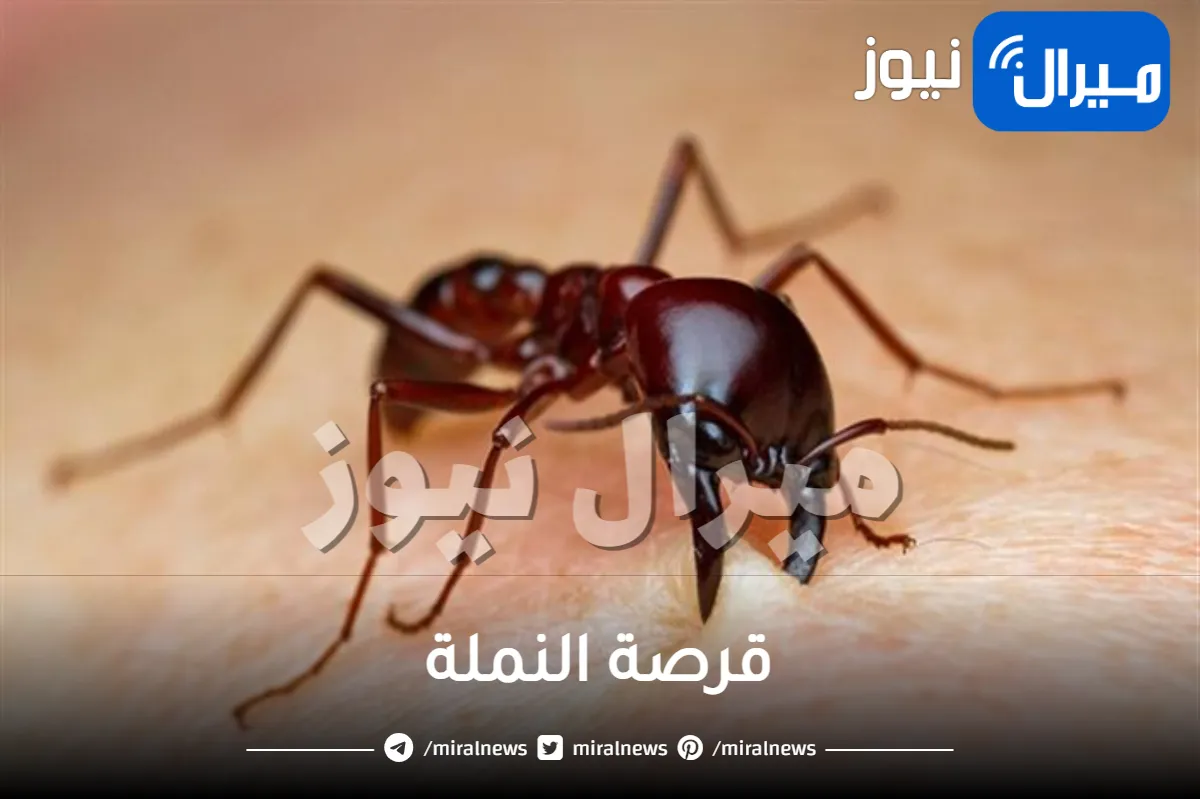 قرصة النملة