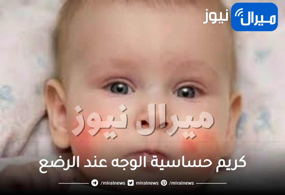 كريم حساسية الوجه عند الرضع