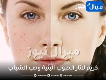 كريم لاثار الحبوب البنية وحب الشباب