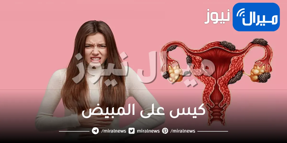 كيس على المبيض