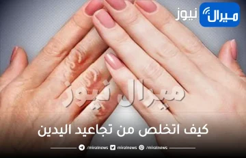كيف ازيل تجاعيد اليدين .. 3 خطوات