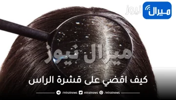 كيف اقضي على قشرة الراس