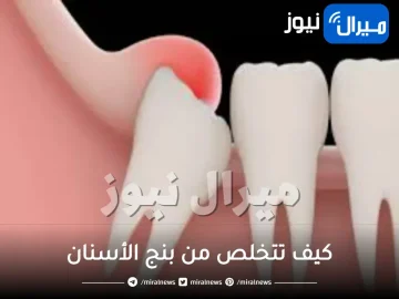 كيف تتخلص من بنج الأسنان