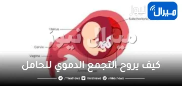 كيف يروح التجمع الدموي للحامل
