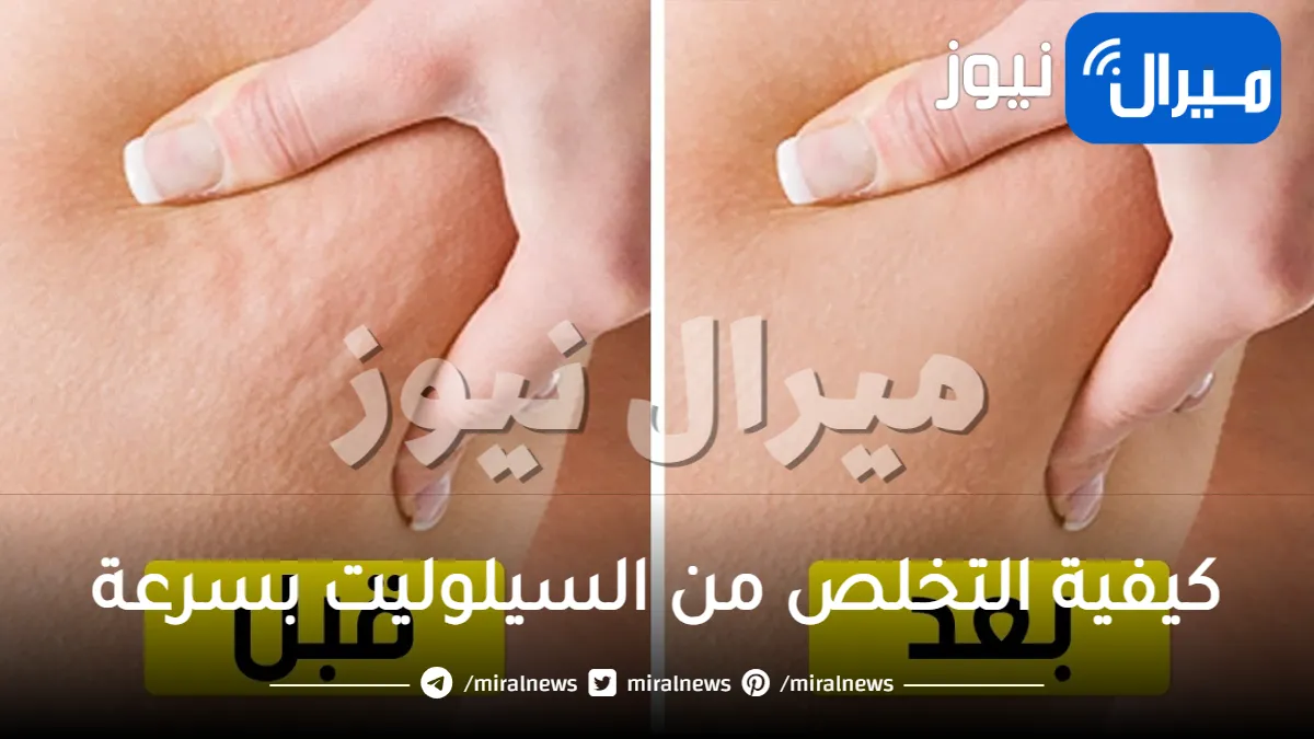 كيفية التخلص من السيلوليت في الفخذين بسرعة