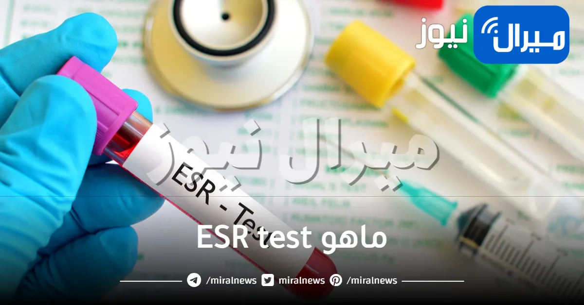 ماهو ESR test