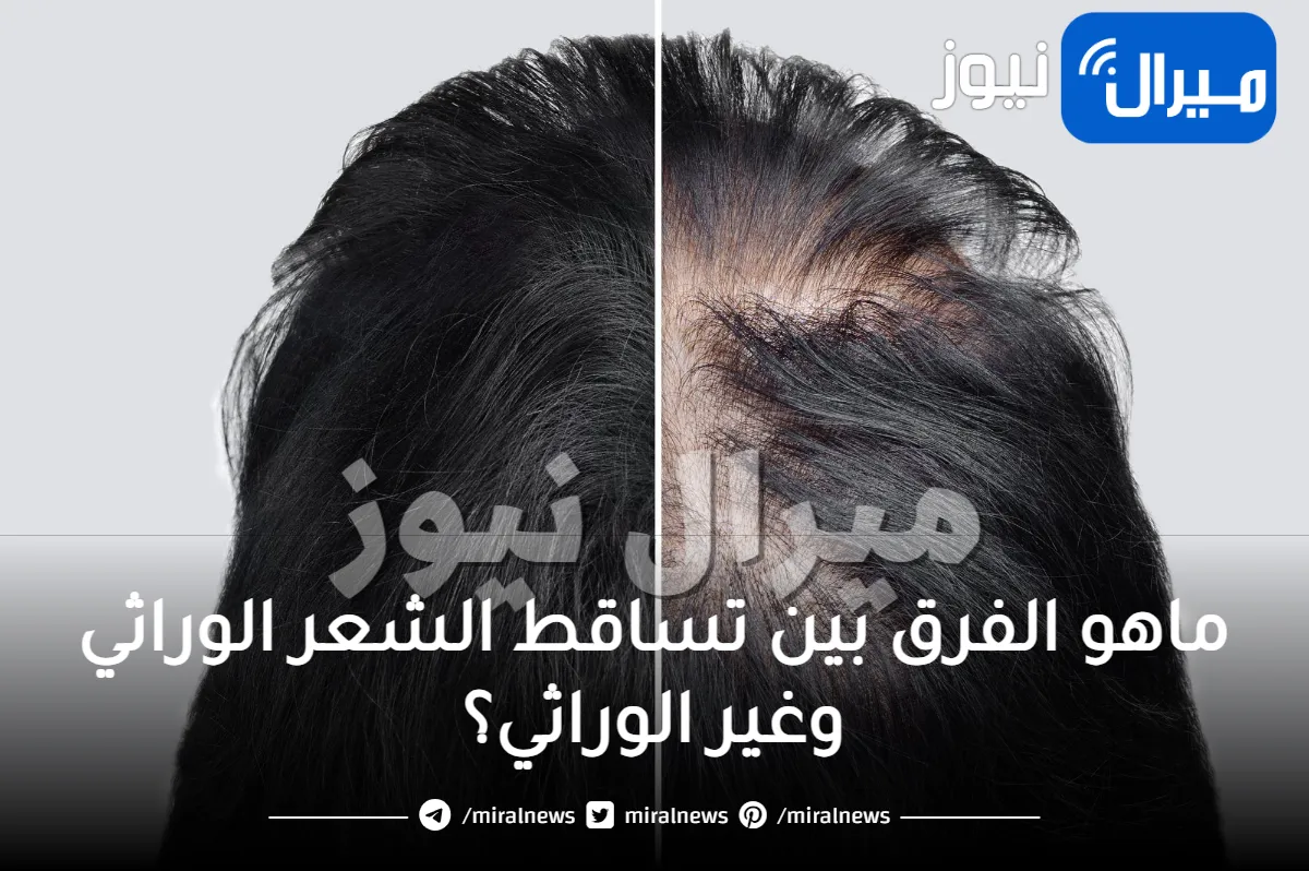 الفرق بين تساقط الشعر الوراثي وغير الوراثي