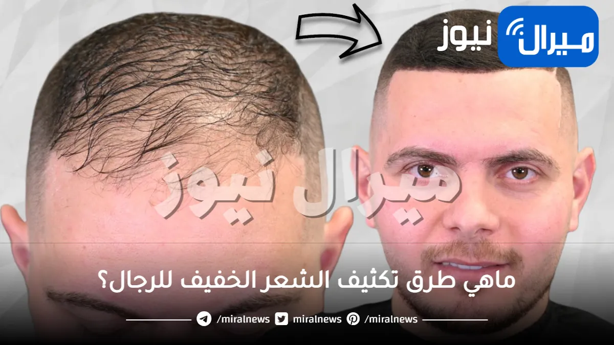 تكثيف الشعر للرجال في اسبوع
