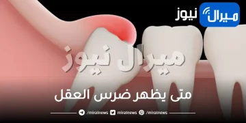 متى يظهر ضرس العقل