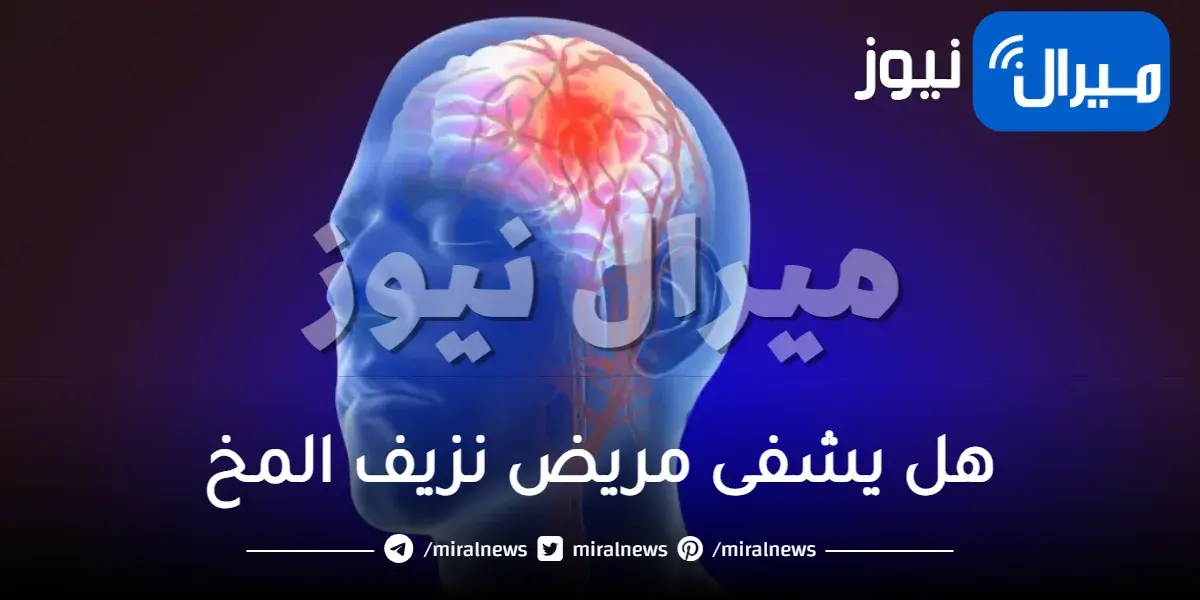 هل يشفى مريض نزيف المخ