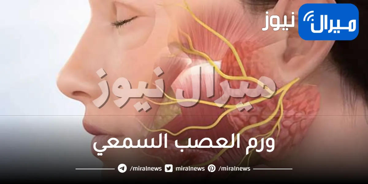 ورم العصب السمعي