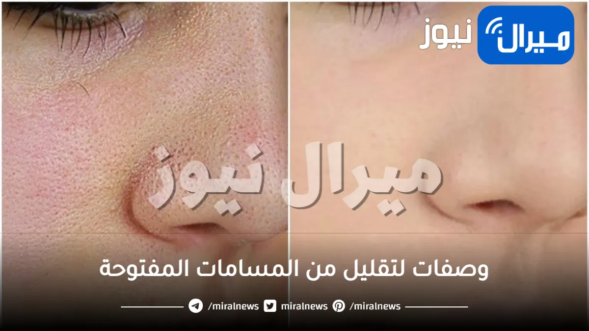 10 وصفات لتقليل من المسامات المفتوحة