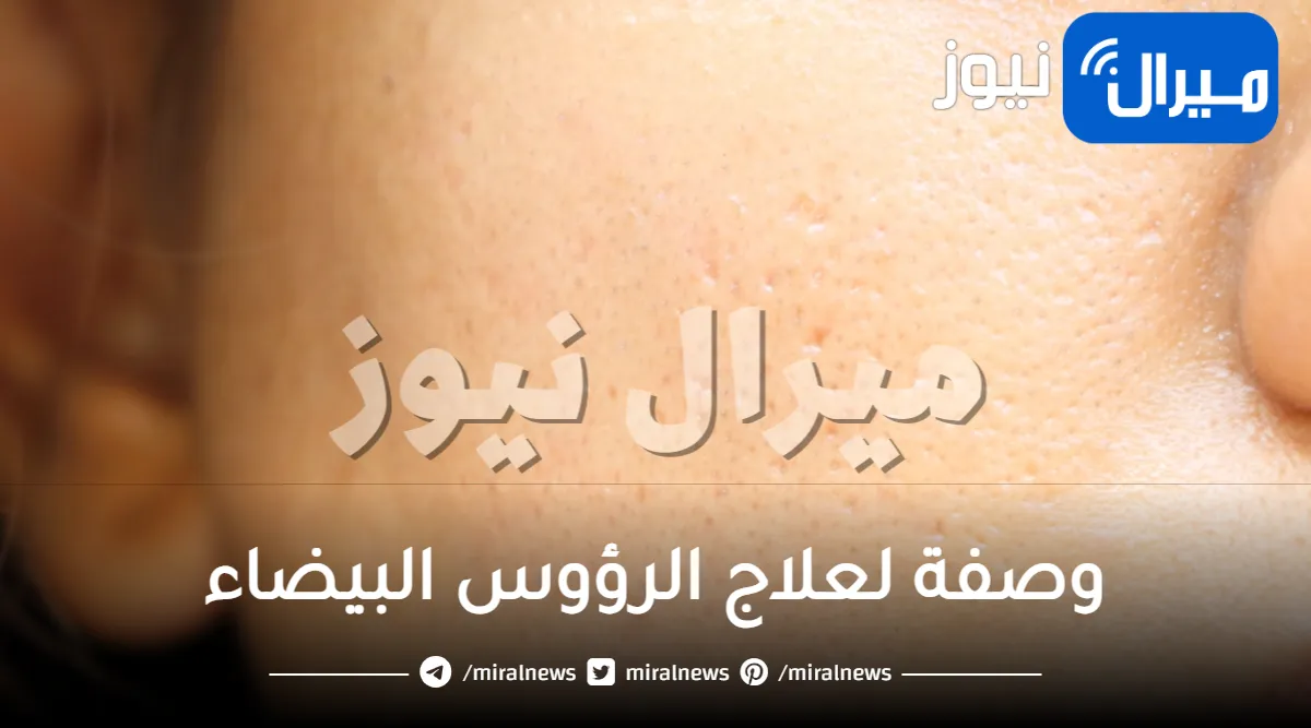 15 وصفة لعلاج الرؤوس البيضاء