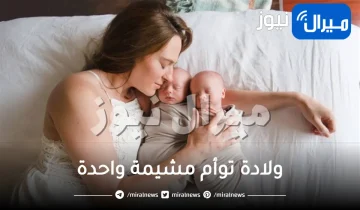 ولادة توأم مشيمة واحدة