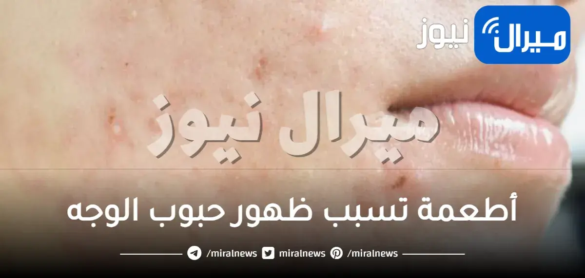 10 أطعمة تسبب ظهور حبوب الوجه