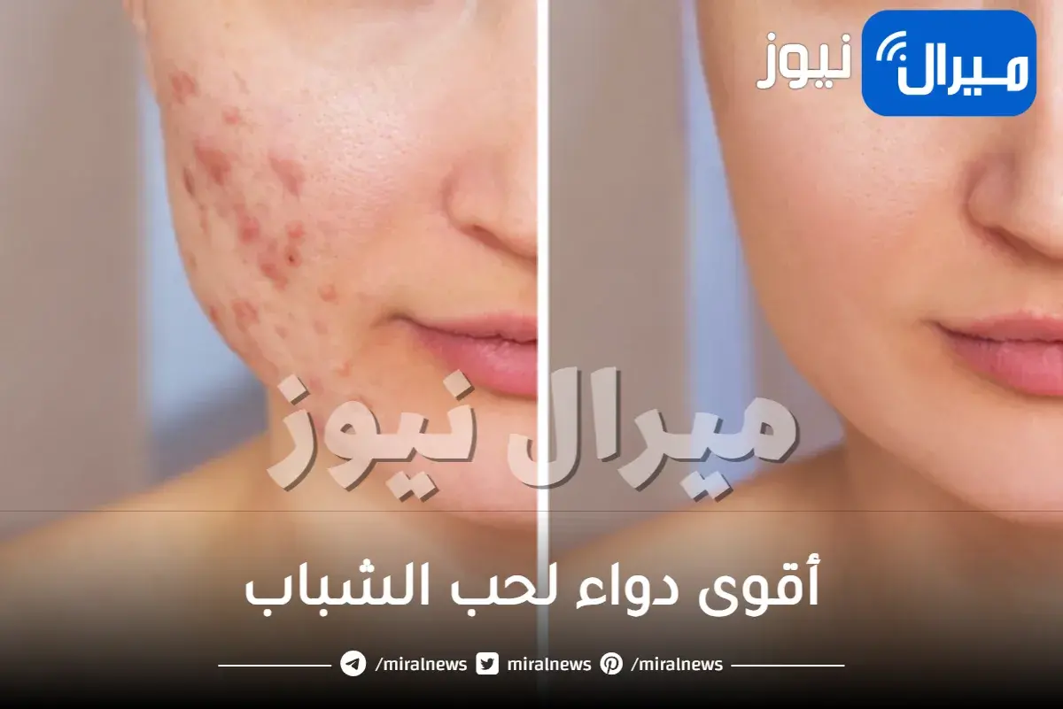 أقوى دواء لحب الشباب