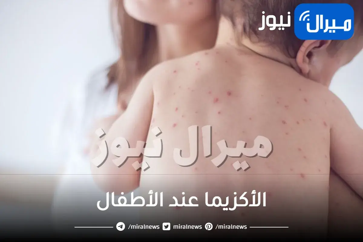 الأكزيما عند الأطفال والعطلة الصيفية