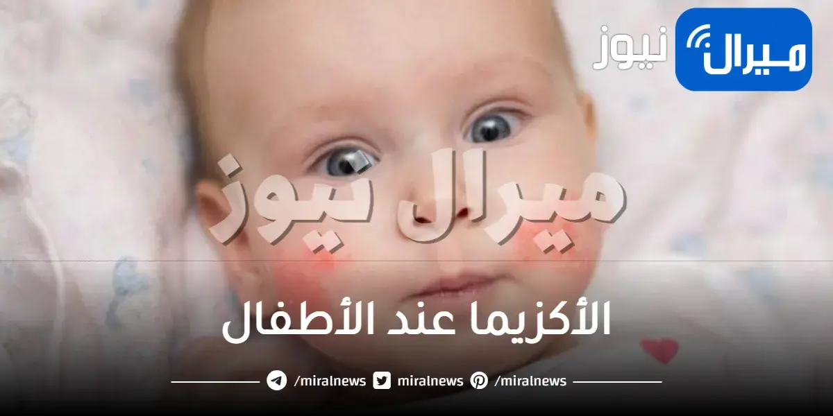 الأكزيما عند الأطفال واختيار الثياب الأنسب