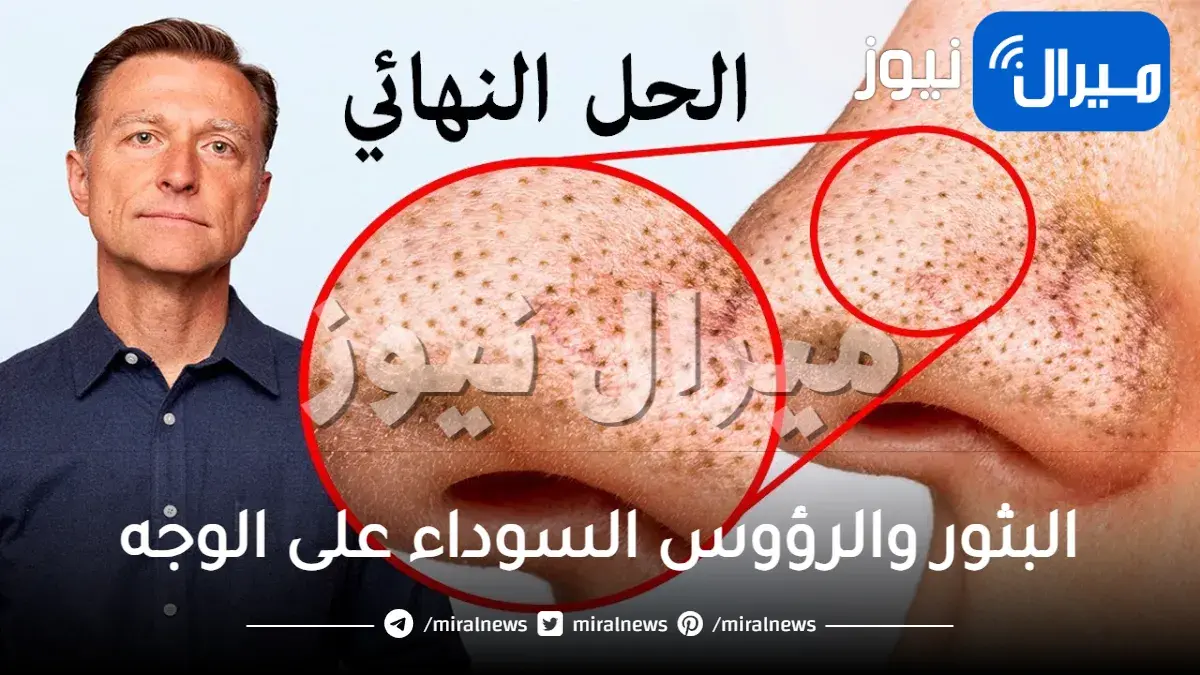 العيوب والبثور والرؤوس السوداء على الوجه: كيف يمكنكِ أن تتصرفي بسرعة؟!