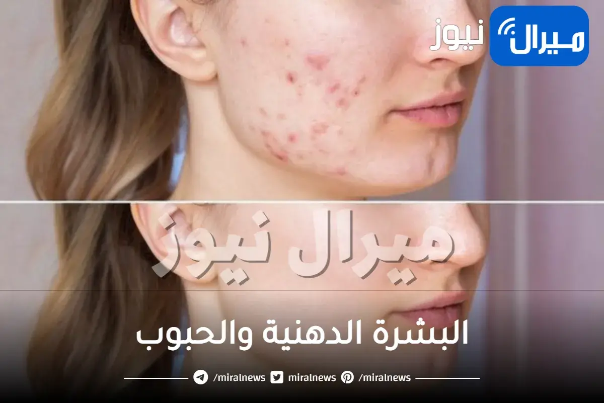 البشرة الدهنية والحبوب