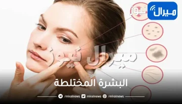 البشرة المختلطة .. أسئلة وأجوبة عن أهم مشاكلها وحلولها