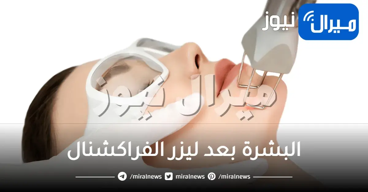 اعتني في البشرة بعد ليزر الفراكشينال لحصد أفضل النتائج