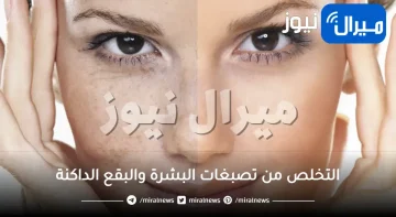 الطرق الطبيعية لإزالة جميع أنواع تصبغات البشرة والبقع الداكنة بين يديك