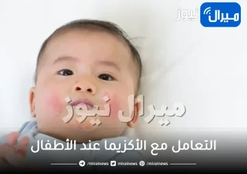التعامل مع الأكزيما عند الأطفال خلال النوم
