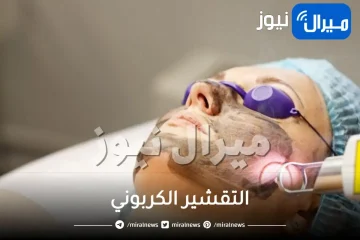 آلية عمل التقشير الكربوني وفوائده
