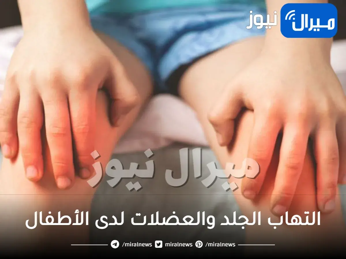 ماهو التهاب الجلد والعضلات لدى الأطفال واعراضه واسبابه وعلاجه