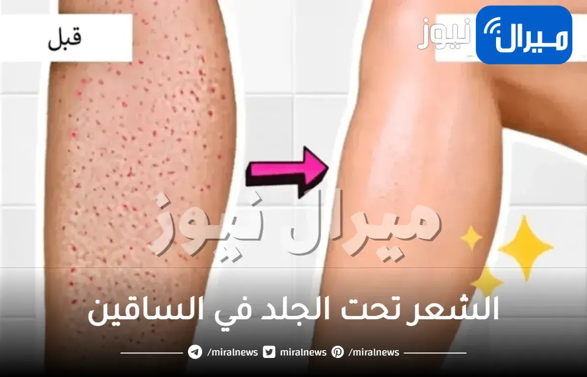 الشعر تحت الجلد في الساقين .. الأسباب وطرق العلاج