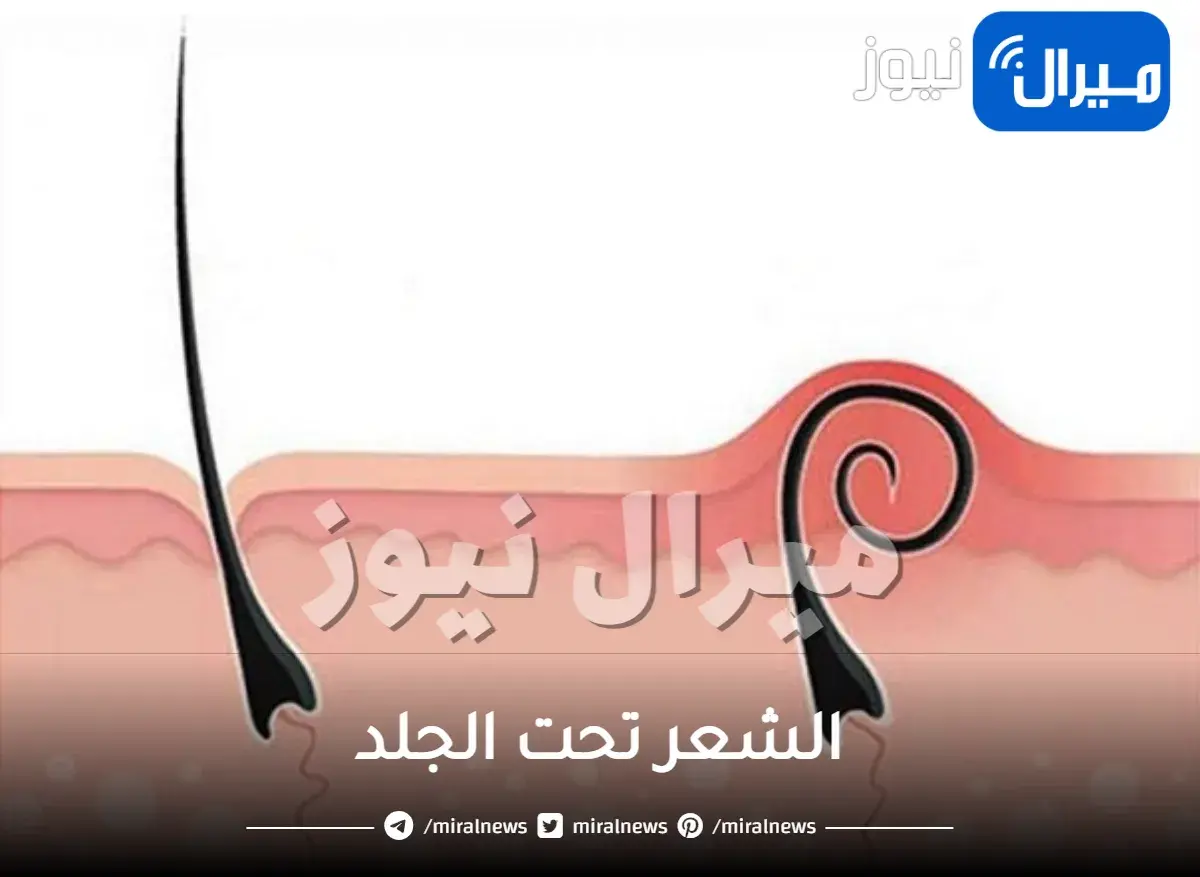 الشعر تحت الجلد.. أسبابه وطرق الوقاية منه وطرق علاجه