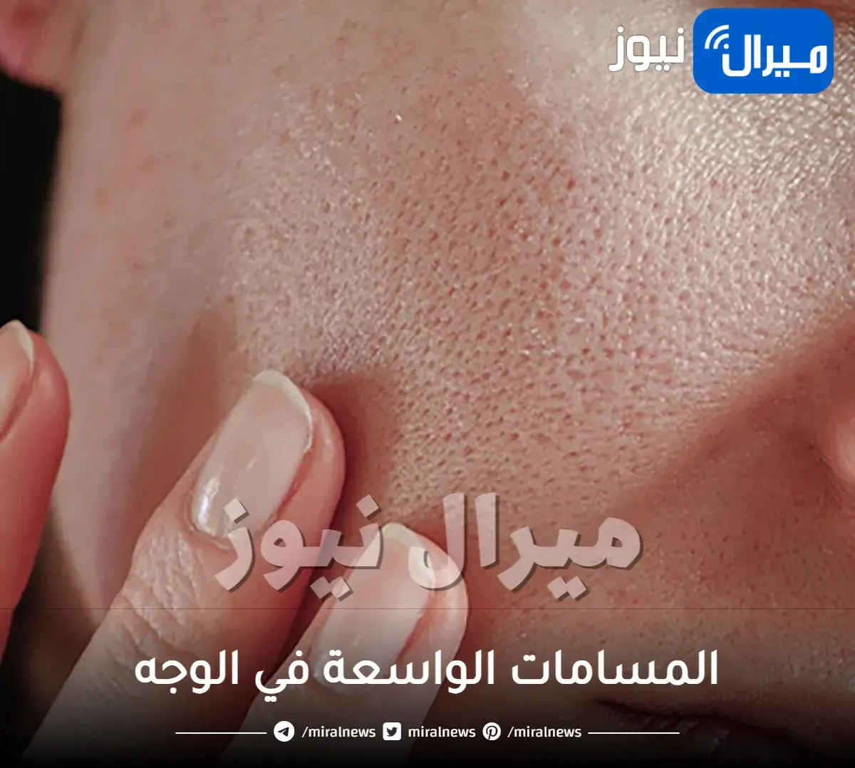المسامات الواسعة في الوجه، الأسباب وجميع طرق العلاج