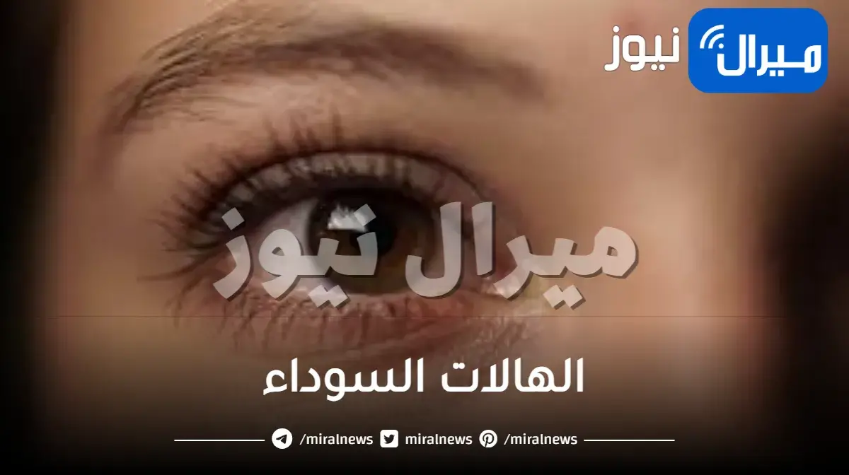 أهم 10 أسئلة وأجوبة عن الهالات السوداء