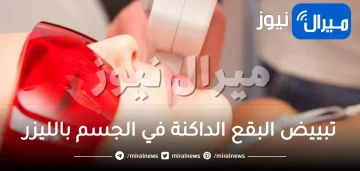 آلية تبييض البقع الداكنة في الجسم بالليزر وأنواعها