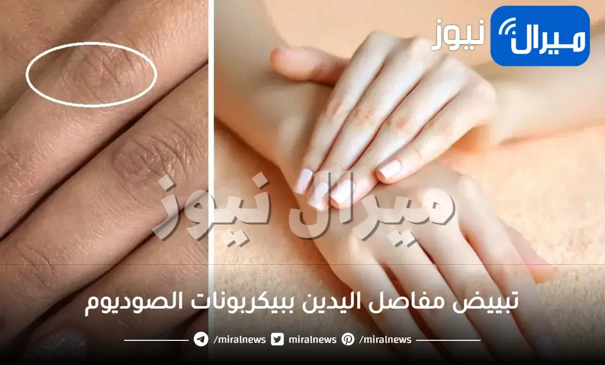 تبييض مفاصل اليدين ببيكربونات الصوديوم