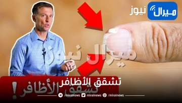 تشقق الأظافر .. ما هي الاسباب ما هو العلاج وهل من وقاية؟
